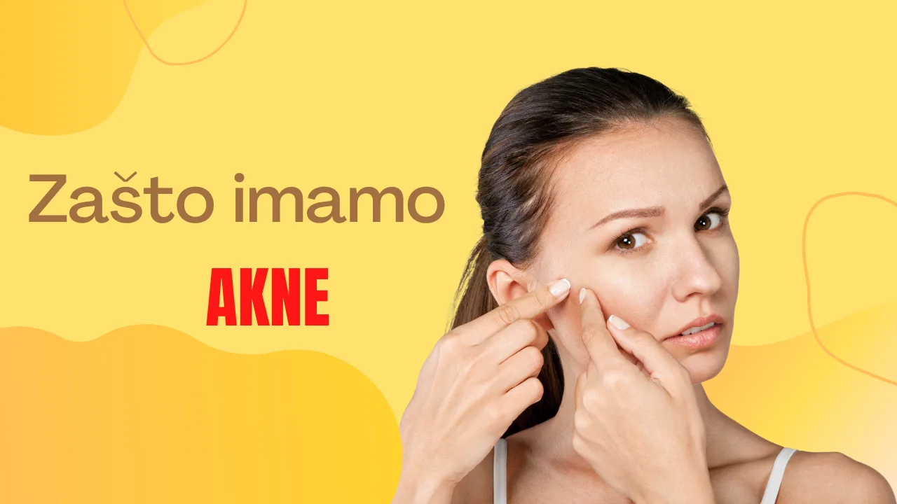 Prištići (akne) – Zašto imamo akne?